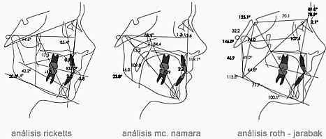 cefalometria lateral