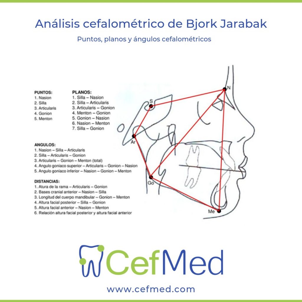 Medidas Jarabak, puntos, planos y demás información del Análisis Cefalométrico de Bjork Jarabak
