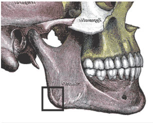 Esta región sufre variaciones dependiendo del biotipo del paciente. Son principalmente por la demanda de contracción muscular correspondiente a las inserciones del musculo pterigoideo medio (cara interna) y masetero (cara externa).