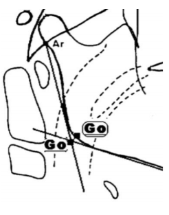 Las tangentes al borde posterior de la rama ascendente y al borde inferior del cuerpo mandibular.