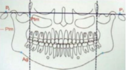 Ortopantomografía en CefMed